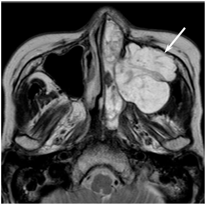 https://cdn.ncbi.nlm.nih.gov/pmc/blobs/b9e8/5742805/08fa420a9a21/jcm-06-00116-g003.jpg