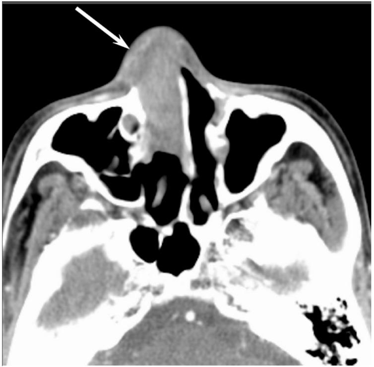 https://cdn.ncbi.nlm.nih.gov/pmc/blobs/b9e8/5742805/2c8c7298956b/jcm-06-00116-g004.jpg