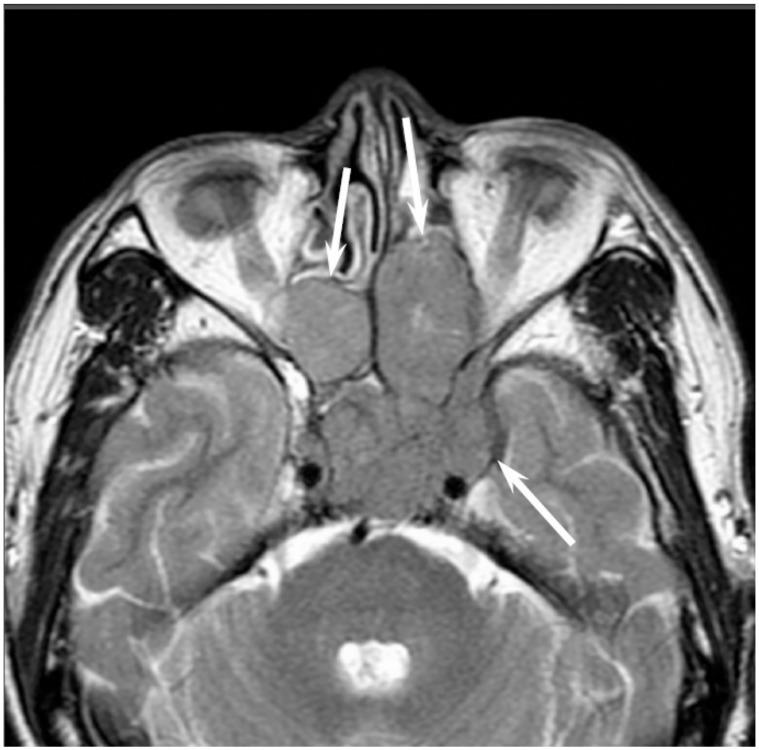 https://cdn.ncbi.nlm.nih.gov/pmc/blobs/b9e8/5742805/39c72b805fd6/jcm-06-00116-g006.jpg