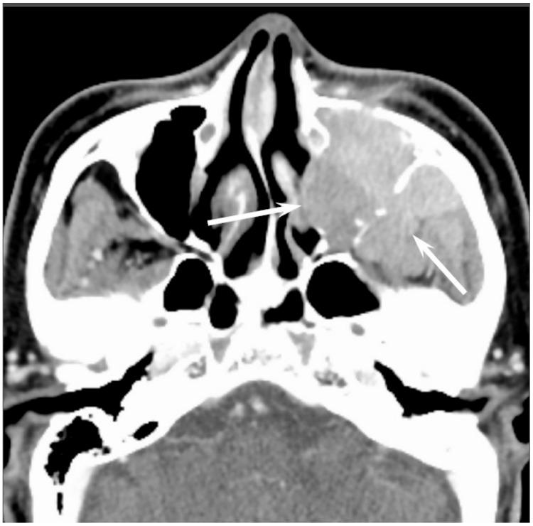 https://cdn.ncbi.nlm.nih.gov/pmc/blobs/b9e8/5742805/3af26497ab3e/jcm-06-00116-g005.jpg