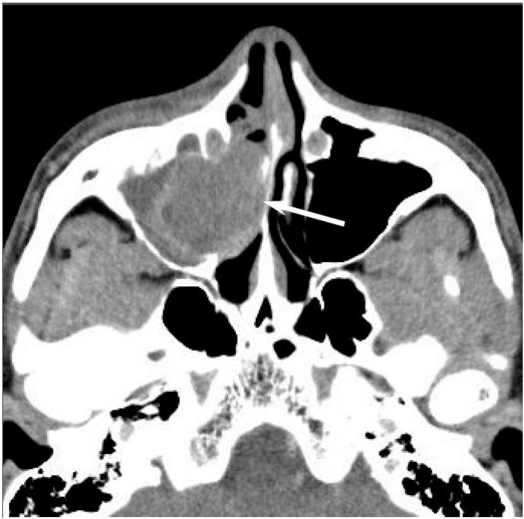 https://cdn.ncbi.nlm.nih.gov/pmc/blobs/b9e8/5742805/4f28d2849567/jcm-06-00116-g009.jpg