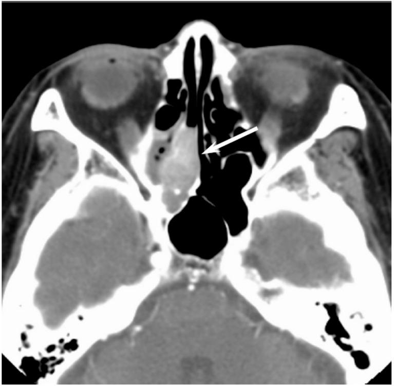 https://cdn.ncbi.nlm.nih.gov/pmc/blobs/b9e8/5742805/c2215adea8f1/jcm-06-00116-g007.jpg