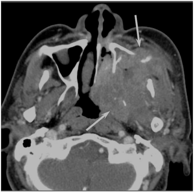 https://cdn.ncbi.nlm.nih.gov/pmc/blobs/b9e8/5742805/c9af02618c86/jcm-06-00116-g001.jpg
