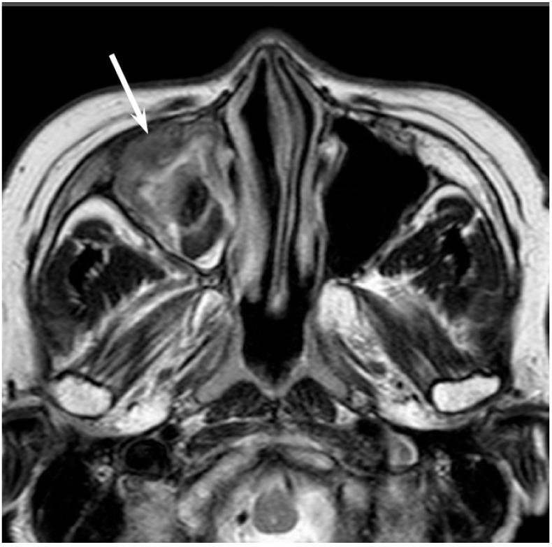 https://cdn.ncbi.nlm.nih.gov/pmc/blobs/b9e8/5742805/ebf380fb294d/jcm-06-00116-g010.jpg