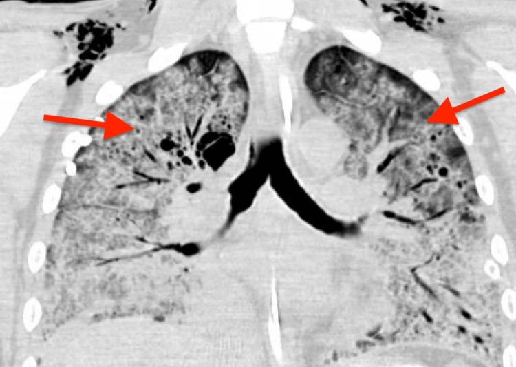 https://cdn.ncbi.nlm.nih.gov/pmc/blobs/b9e9/11975790/c8b6418733b3/cureus-0017-00000080273-i01.jpg