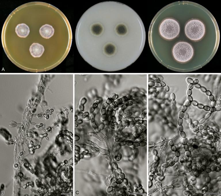 https://cdn.ncbi.nlm.nih.gov/pmc/blobs/b9e9/3233907/3365118036b6/1fig3.jpg