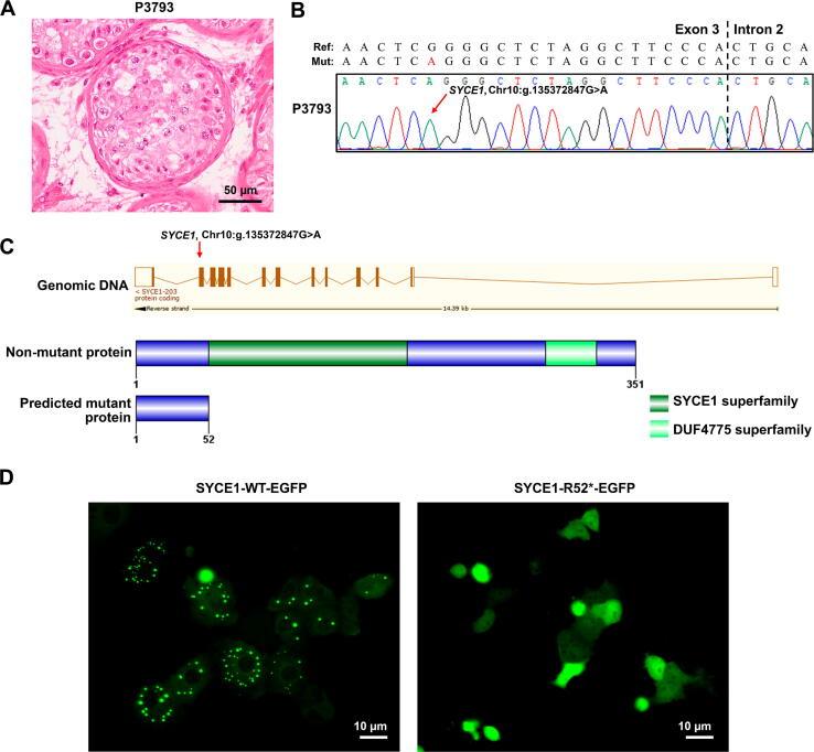 https://cdn.ncbi.nlm.nih.gov/pmc/blobs/b9ec/9801063/5fb7a618beb9/gr4.jpg
