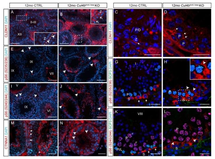 https://cdn.ncbi.nlm.nih.gov/pmc/blobs/b9f0/8535100/32e28919bf49/cells-10-02732-g006.jpg