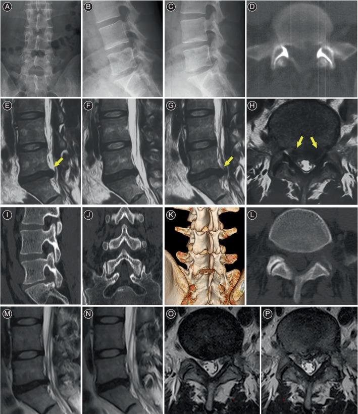 https://cdn.ncbi.nlm.nih.gov/pmc/blobs/b9f2/11608791/095b6a957fd3/OS-16-3014-g004.jpg