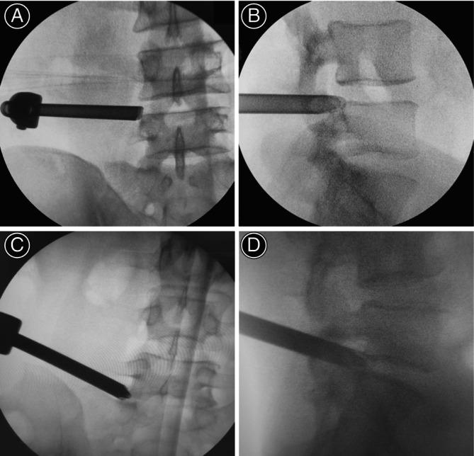https://cdn.ncbi.nlm.nih.gov/pmc/blobs/b9f2/11608791/cbc01c587f00/OS-16-3014-g002.jpg