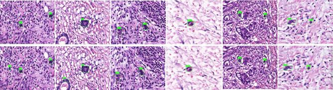 https://cdn.ncbi.nlm.nih.gov/pmc/blobs/b9f5/7982570/1359c08f5074/fonc-11-626626-g003.jpg
