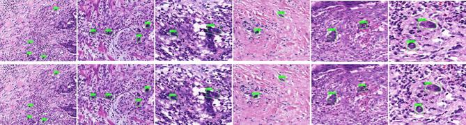https://cdn.ncbi.nlm.nih.gov/pmc/blobs/b9f5/7982570/48a89ba6cc87/fonc-11-626626-g002.jpg