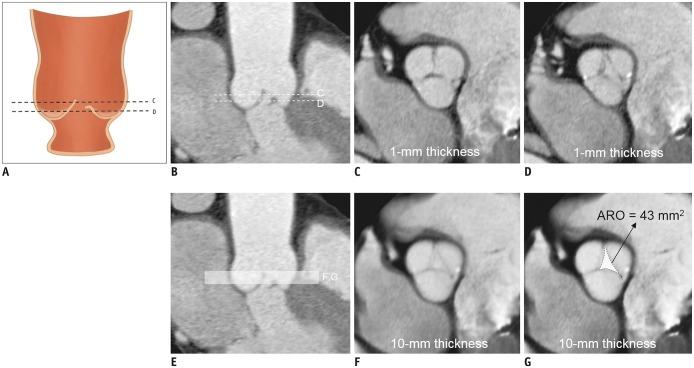 https://cdn.ncbi.nlm.nih.gov/pmc/blobs/b9f6/6992440/026ede90d8b6/kjr-21-181-g001.jpg