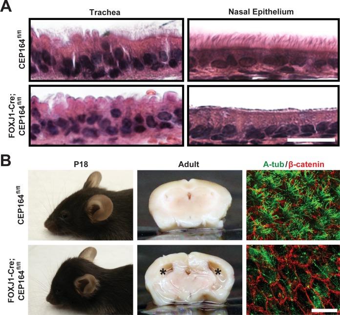 https://cdn.ncbi.nlm.nih.gov/pmc/blobs/b9fa/5747467/f6f8df468f9d/pgen.1007128.g002.jpg