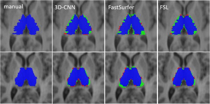 https://cdn.ncbi.nlm.nih.gov/pmc/blobs/b9fa/9935653/221f3eaff1ea/330_2022_9170_Fig4_HTML.jpg