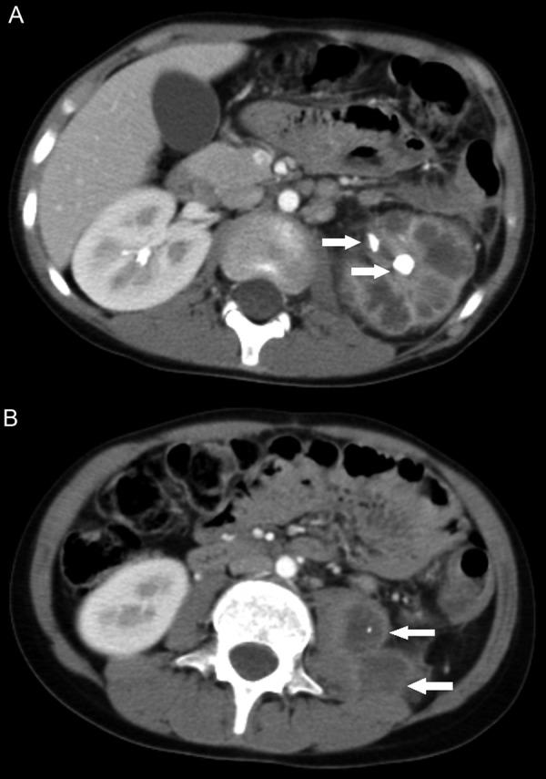 https://cdn.ncbi.nlm.nih.gov/pmc/blobs/b9fe/5437995/e6d219f3ec7a/CNCS-3-025-01.jpg