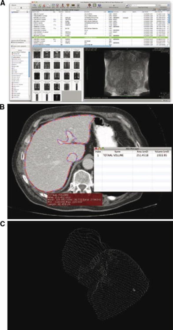 https://cdn.ncbi.nlm.nih.gov/pmc/blobs/ba01/2936678/ac553b41b2aa/268_2010_663_Fig1_HTML.jpg