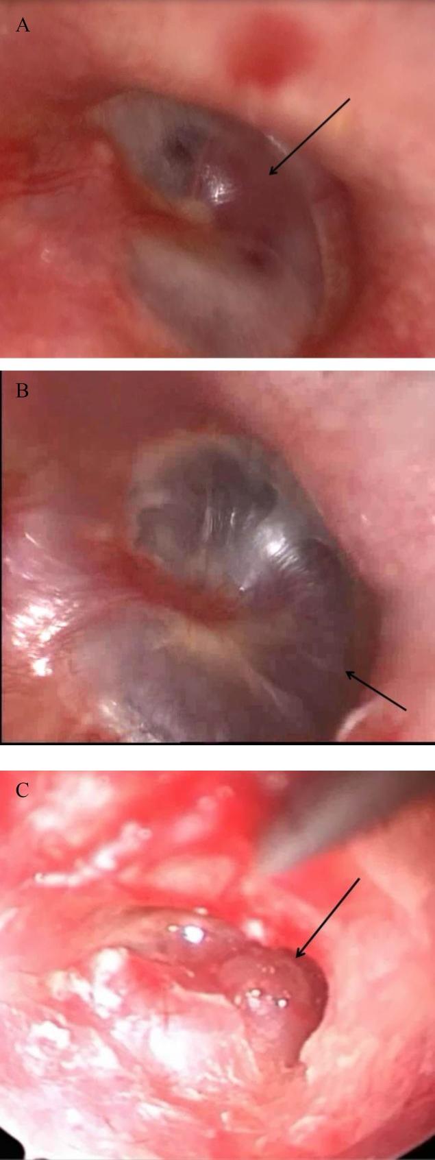 https://cdn.ncbi.nlm.nih.gov/pmc/blobs/ba0a/5785109/1ae2c84e264c/ijo-29-305-g001.jpg