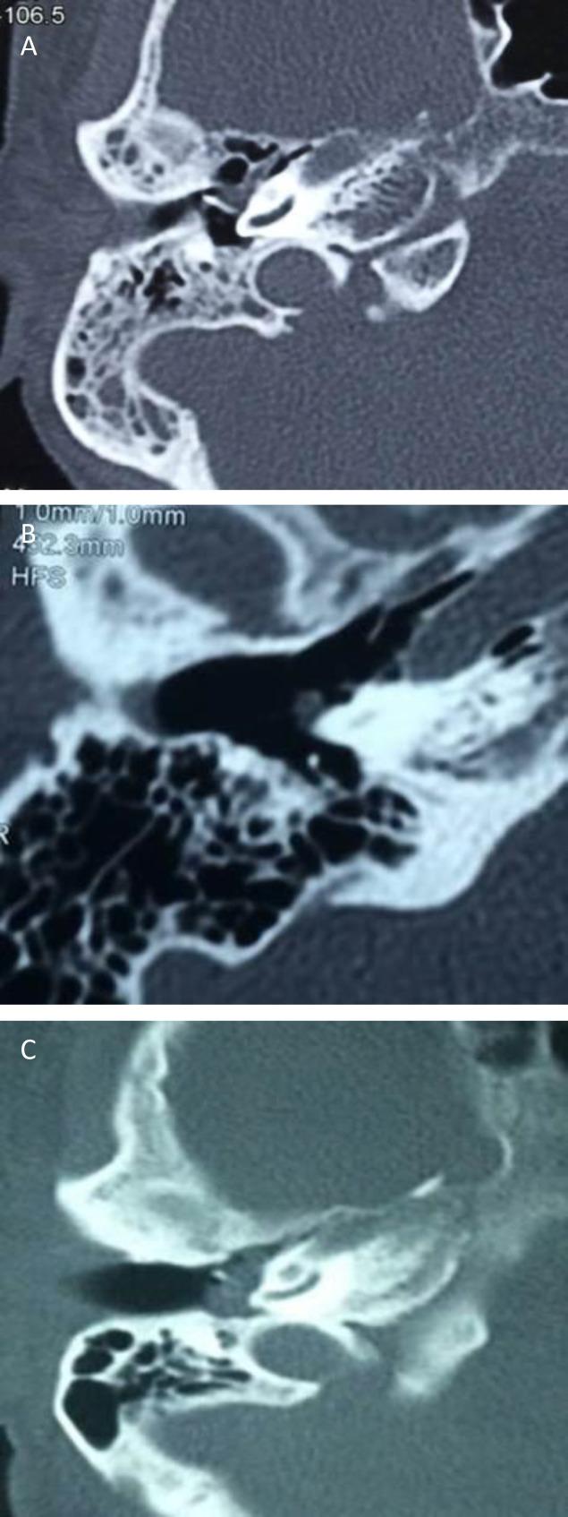 https://cdn.ncbi.nlm.nih.gov/pmc/blobs/ba0a/5785109/937e0d0d8368/ijo-29-305-g002.jpg