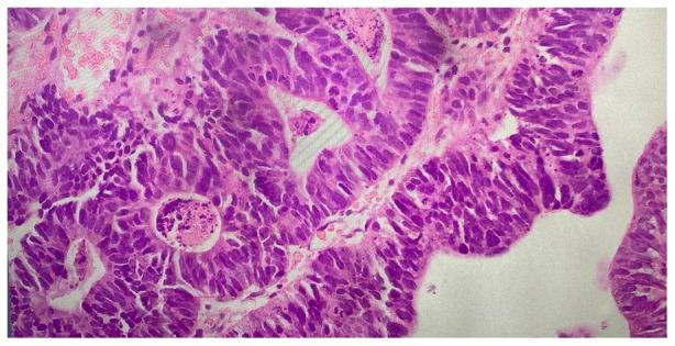 https://cdn.ncbi.nlm.nih.gov/pmc/blobs/ba0d/9791279/1754696b59bb/10.1177_2632010X221145537-fig2.jpg