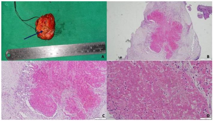 https://cdn.ncbi.nlm.nih.gov/pmc/blobs/ba0d/9791279/4b18d4c0b127/10.1177_2632010X221145537-fig4.jpg