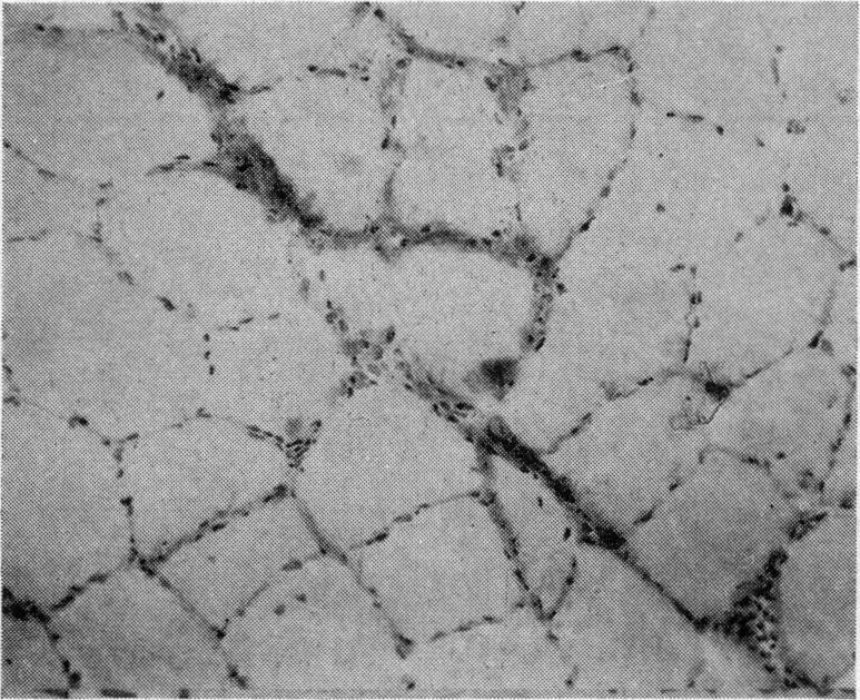 https://cdn.ncbi.nlm.nih.gov/pmc/blobs/ba10/1897185/0ea19355e428/procrsmed00217-0077-d.jpg