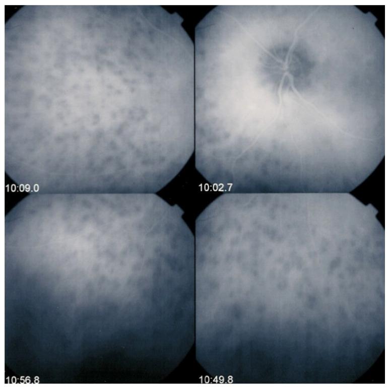 https://cdn.ncbi.nlm.nih.gov/pmc/blobs/ba10/8225100/026cc3831037/diagnostics-11-00939-g005.jpg