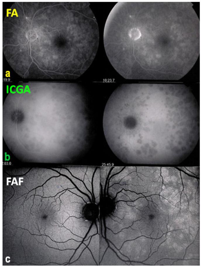 https://cdn.ncbi.nlm.nih.gov/pmc/blobs/ba10/8225100/0e65b58531d2/diagnostics-11-00939-g007.jpg