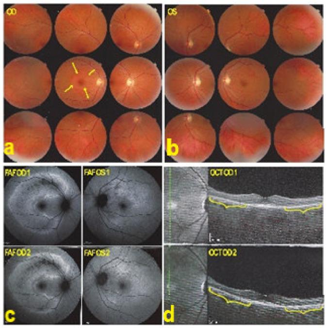 https://cdn.ncbi.nlm.nih.gov/pmc/blobs/ba10/8225100/20e1c2d441dc/diagnostics-11-00939-g036.jpg