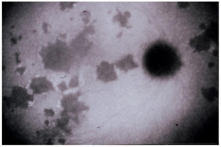 https://cdn.ncbi.nlm.nih.gov/pmc/blobs/ba10/8225100/2545d1b6ff1a/diagnostics-11-00939-g004.jpg