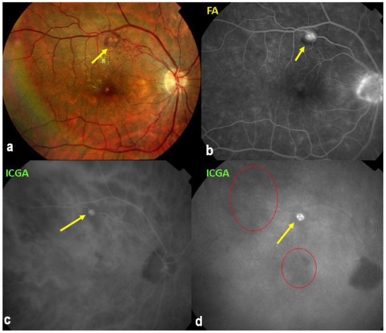 https://cdn.ncbi.nlm.nih.gov/pmc/blobs/ba10/8225100/3c5009a5b467/diagnostics-11-00939-g053.jpg