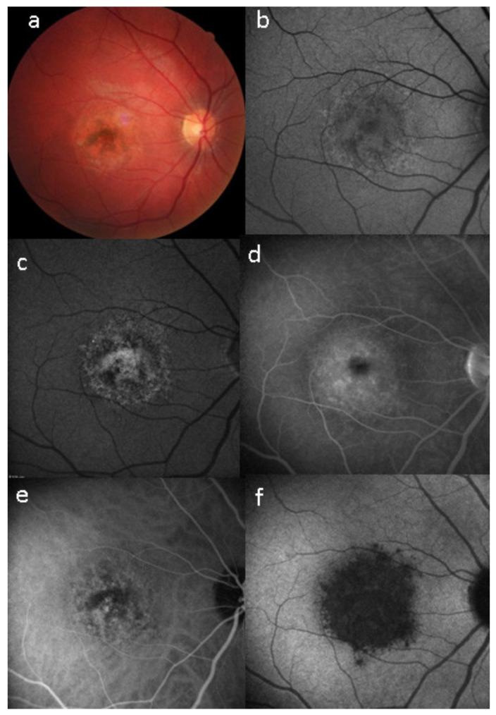 https://cdn.ncbi.nlm.nih.gov/pmc/blobs/ba10/8225100/5642a2d128e0/diagnostics-11-00939-g033.jpg
