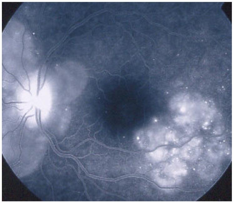 https://cdn.ncbi.nlm.nih.gov/pmc/blobs/ba10/8225100/bfe20dd07f9e/diagnostics-11-00939-g048.jpg