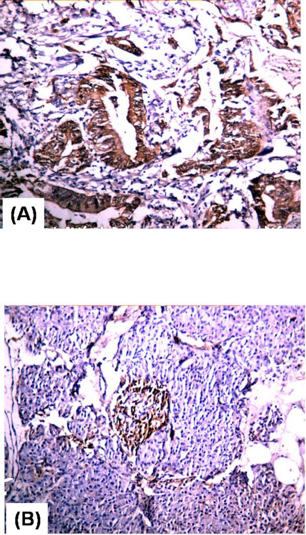 https://cdn.ncbi.nlm.nih.gov/pmc/blobs/ba11/1185532/38c82e33dd28/1471-230X-5-22-5.jpg