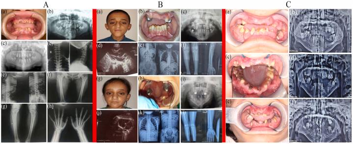 https://cdn.ncbi.nlm.nih.gov/pmc/blobs/ba18/10772639/3775b9cc79ba/gr2.jpg