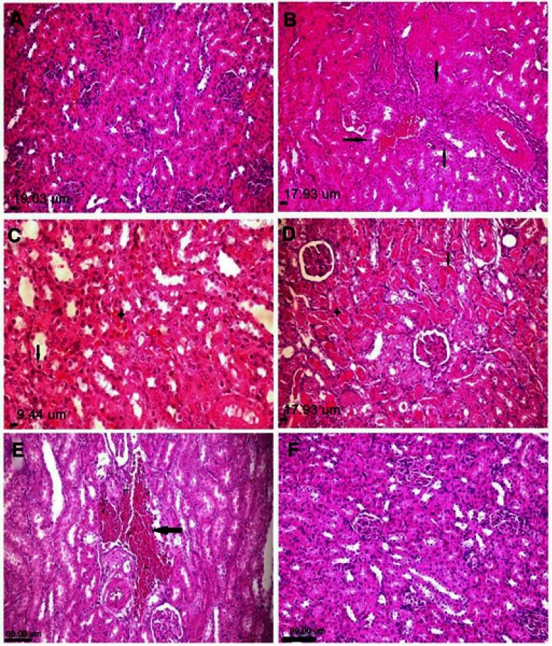 https://cdn.ncbi.nlm.nih.gov/pmc/blobs/ba18/6614591/1b202cf91122/IJN-14-4723-g0005.jpg