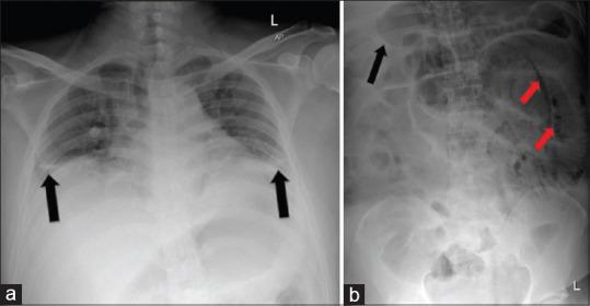 https://cdn.ncbi.nlm.nih.gov/pmc/blobs/ba22/7305666/cd2d41769d36/TJEM-20-86-g001.jpg