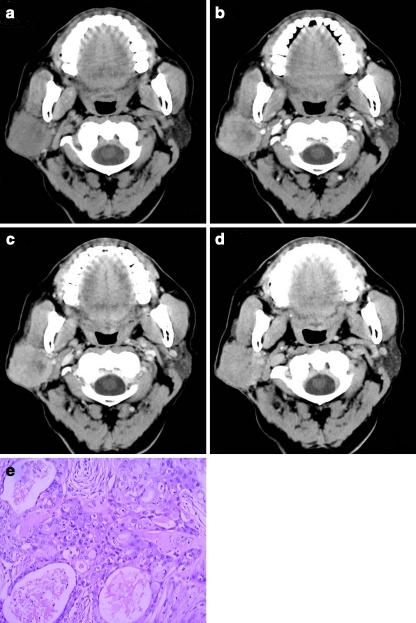 https://cdn.ncbi.nlm.nih.gov/pmc/blobs/ba24/3128264/e1c108d646d3/330_2011_2101_Fig1_HTML.jpg