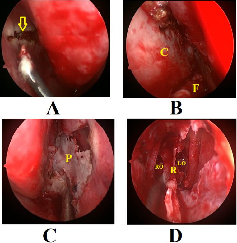 https://cdn.ncbi.nlm.nih.gov/pmc/blobs/ba26/12055946/3c0f660df712/405_2025_9342_Fig1_HTML.jpg