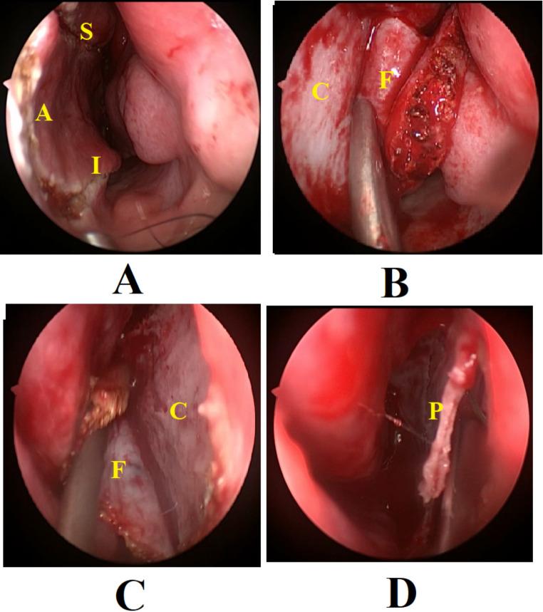 https://cdn.ncbi.nlm.nih.gov/pmc/blobs/ba26/12055946/5e49a8207d2d/405_2025_9342_Fig2_HTML.jpg