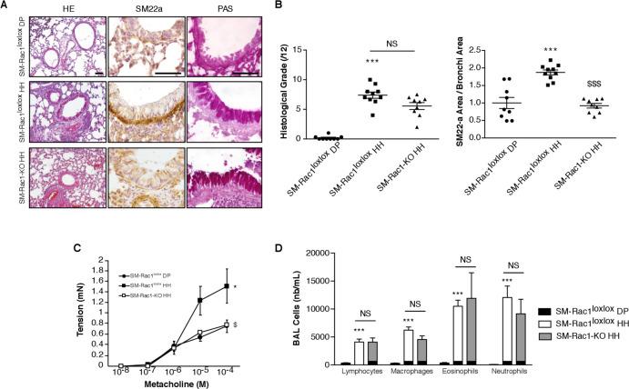 https://cdn.ncbi.nlm.nih.gov/pmc/blobs/ba28/7982925/0a5d0c90ddb8/thoraxjnl-2020-216271f04.jpg