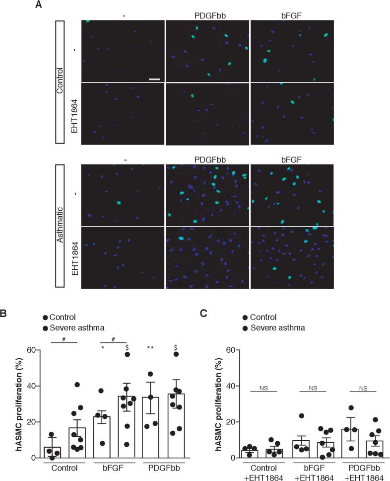 https://cdn.ncbi.nlm.nih.gov/pmc/blobs/ba28/7982925/3ad1b7e70e6b/thoraxjnl-2020-216271f02.jpg