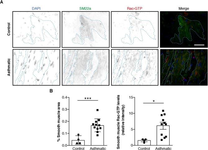 https://cdn.ncbi.nlm.nih.gov/pmc/blobs/ba28/7982925/e29ffdc64cca/thoraxjnl-2020-216271f01.jpg
