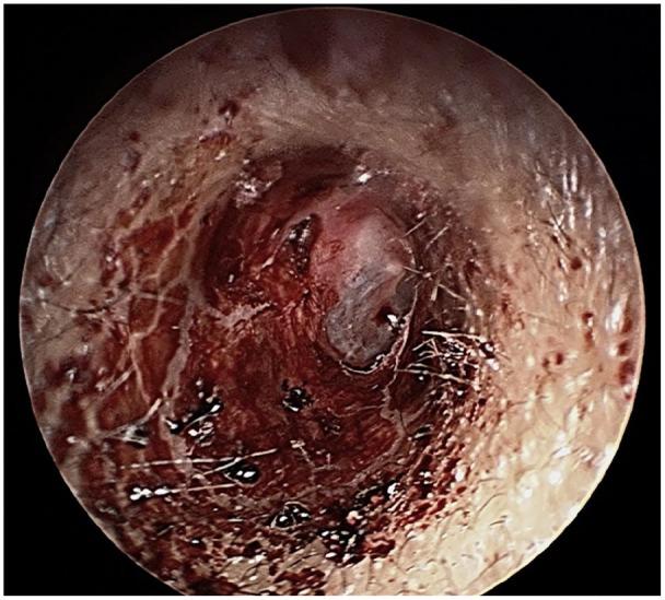 https://cdn.ncbi.nlm.nih.gov/pmc/blobs/ba2f/7958153/14f7cd93180a/10.1177_2050313X211000869-fig1.jpg