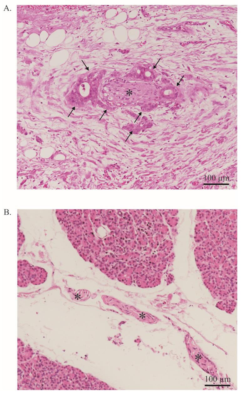 https://cdn.ncbi.nlm.nih.gov/pmc/blobs/ba3b/10573820/dd730844bda2/ijms-24-14989-g002.jpg