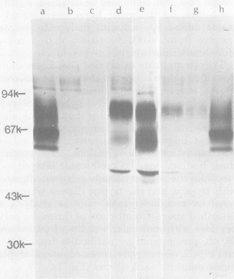 https://cdn.ncbi.nlm.nih.gov/pmc/blobs/ba3b/171353/4851aac259f3/jvirol00008-0120-a.jpg