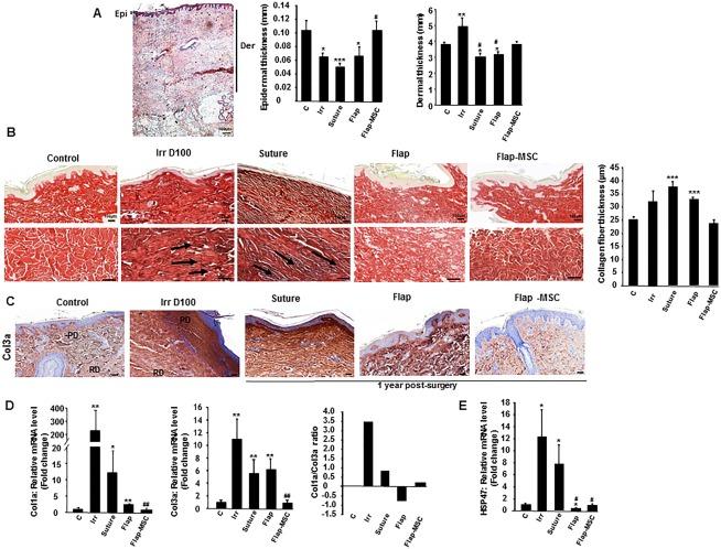 https://cdn.ncbi.nlm.nih.gov/pmc/blobs/ba3c/6090511/8f6bfaabc03a/SCT3-7-569-g002.jpg
