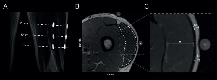 https://cdn.ncbi.nlm.nih.gov/pmc/blobs/ba3d/8638746/63c60ce7f7ce/JRM-53-7-2809-g003.jpg