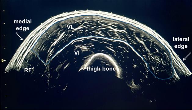 https://cdn.ncbi.nlm.nih.gov/pmc/blobs/ba3d/8638746/a31a6326066d/JRM-53-7-2809-g002.jpg