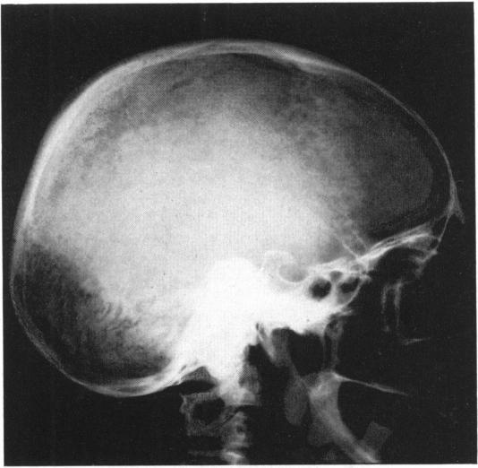 https://cdn.ncbi.nlm.nih.gov/pmc/blobs/ba3f/1543798/46ded54ff0c0/annsurg01338-0078-a.jpg